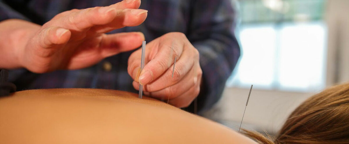 Traditional Chinese Medicine Acupuncture Therapy in Richmond, BC | White Rock 16Ave Physiotherapy & Wellness Clinic